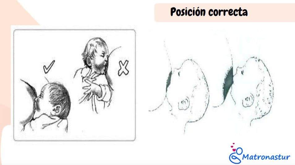 Posición de la cabeza del niño durante lactancia materna